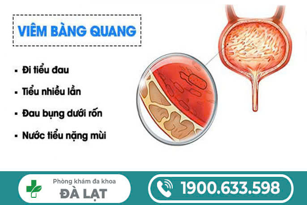 Hình ảnh minh họa